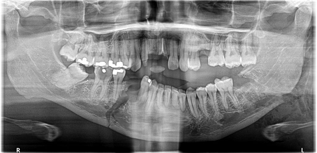 Facial Trauma Sycamore IL | Facial Injury Surgery DeKalb County IL